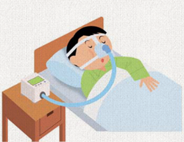 睡眠時無呼吸症候群（CPAP）